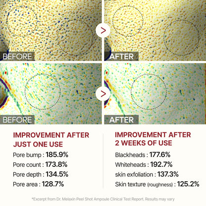 Peel Shot Glow Ampoules by Dr. Melaxin